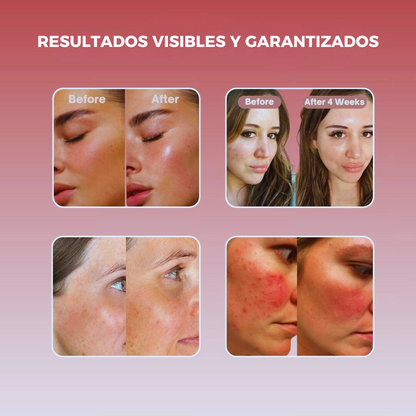 Mascarilla Cóllageno Beauty Green Essence
